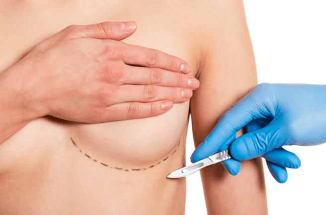 Will my Breast Implants Cause Cancer?